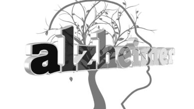 Alzheimers